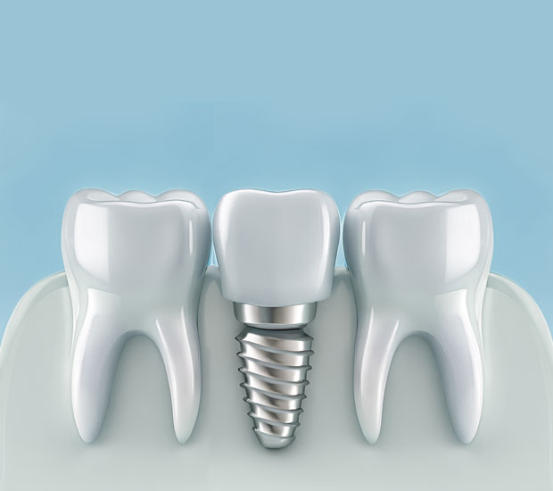 San Jose Periodontist