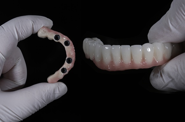 Tired Of Dentures? Try All On Dental Implants