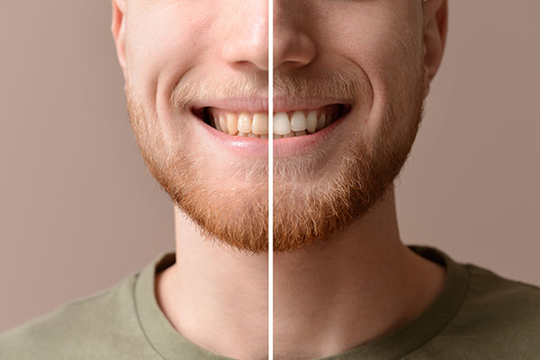 Periodontics: Tips For Healthier Gums