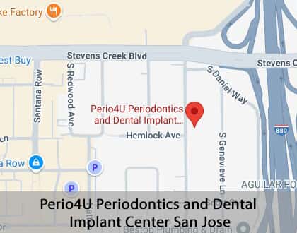 Map image for Periodontics in San Jose, CA